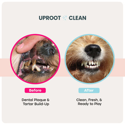 Uproot™ Dental Wipes